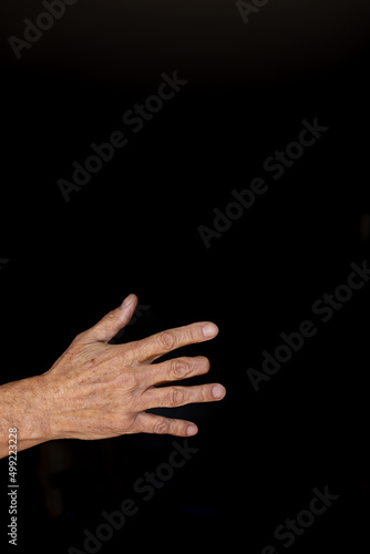 Elderly man right hand with amputated middle finger on black background
