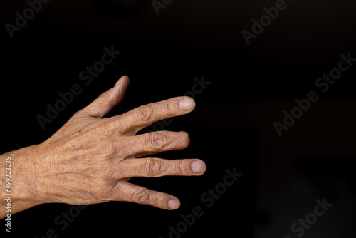 Man's right hand with amputated middle finger against a black background photo