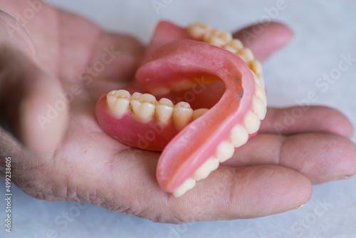 Close-up in the hands of a man removable dentures. Dental prosthetics. false jaw taken in hand. Dental practice.Selective focus