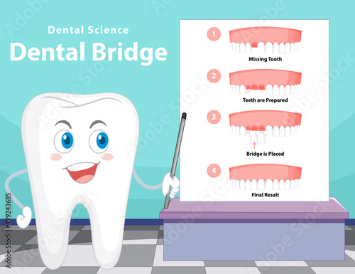 Infographic of human in dental bridge