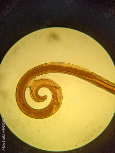 photo of faltworm tissue under the miccoscope