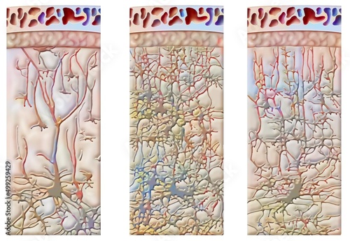 Development of the cell network of the cerebral cortex of a child at 9.