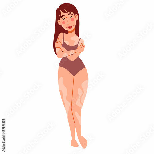 European slender woman with vitiligo. The girl hugs herself. The concept of body positivity, self-acceptance. skin disease vitiligo. Vector isolated illustration in a flat style on a white background.