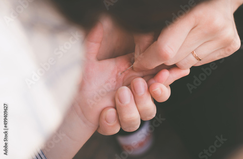 A woman takes a splinter out of a child's hand with a needle. A splinter in a child's hand photo