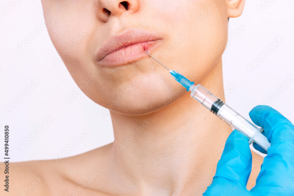 Cropped shot of young woman's face with syringe needle on her lips held by doctor's hand in a blue glove isolated on a white background. Injection of filler in lips. Lip augmentation, enhancement