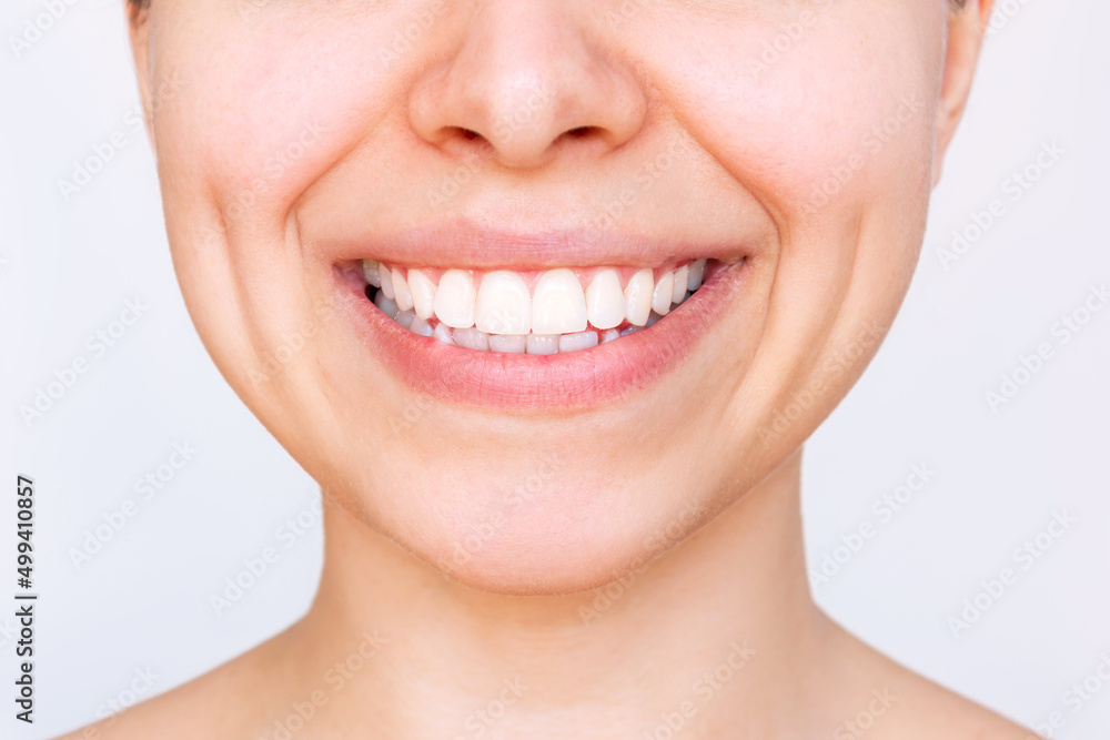 Obraz premium Cropped shot of a young caucasian smiling woman with perfect white even teeth isolated on a white background. Oral hygiene, dental health care. Veneers, teeth whitening. Dentistry