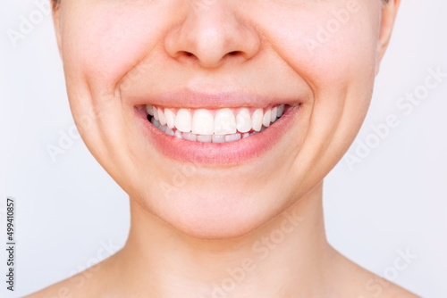 Cropped shot of a young caucasian smiling woman with perfect white even teeth isolated on a white background. Oral hygiene, dental health care. Veneers, teeth whitening. Dentistry