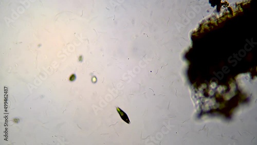 microorganisms in a drop of water from a freshwater lake