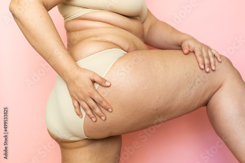 Cropped image of overweight woman sag hips, buttocks, with obesity, excess fat in lingerie. Fast gain weight. Stomach flabs. Dehydrated, flabby skin. Need plastic surgery and rejuvenating skin