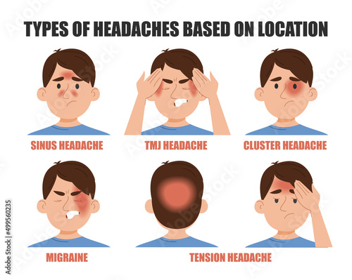 Types of headache based on location vector isolated. Pain in different areas of head. Migraine, sinus, cluster, tmj or tension headache. Man suffering from pain.