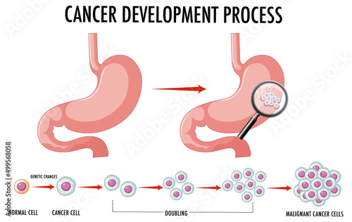 Diagram showing normal and cancer cells in human