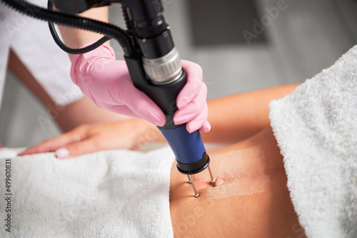 Close up cosmetologist hand in sterile gloves using erbium ablative laser machine while performing lifting procedure on female abdomen. Young woman receiving laser treatment in cosmetology clinic. photo