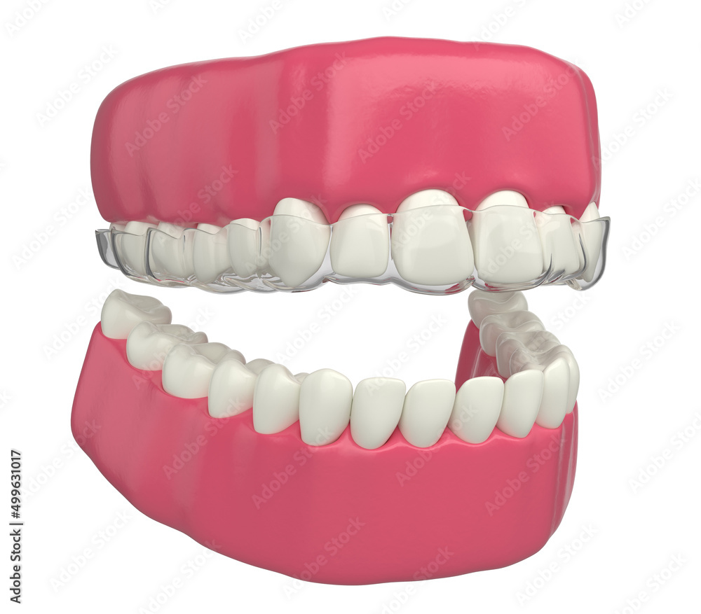 Obraz premium invisible orthodontic teeth 3d illustration on white background