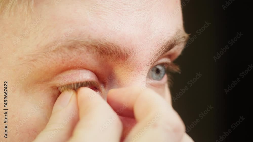 Close-up of a blue-eyed young man taking off contact lens with fingers and blinking. Advertising of contact lenses for vision improvement. Optical shop, health care and medicine concept. Close-up of a blue-eyed young man taking off contact lens with fingers and blinking. Advertising of contact lenses for vision improvement. Optical shop, health care and medicine concept.