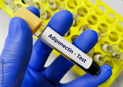 Blood sample for Adiponectin test. This is a protein hormone and adipokine, which is involved in regulating glucose levels as well as fatty acid breakdown. photo