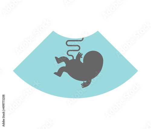 Ultrasound picture of pregnant women. Study of the birth fetus.