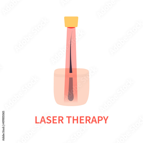 Laser hair growth stimulation. Red light therapy for hair restoration in androgenetic alopecia. Medical concept. Vector illustration.