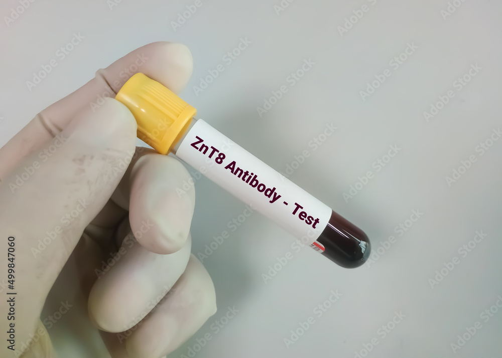 Obraz premium Zinc transporter 8 (ZnT8) antibody test to distinguishes type 1 and type 2 diabetes mellitus