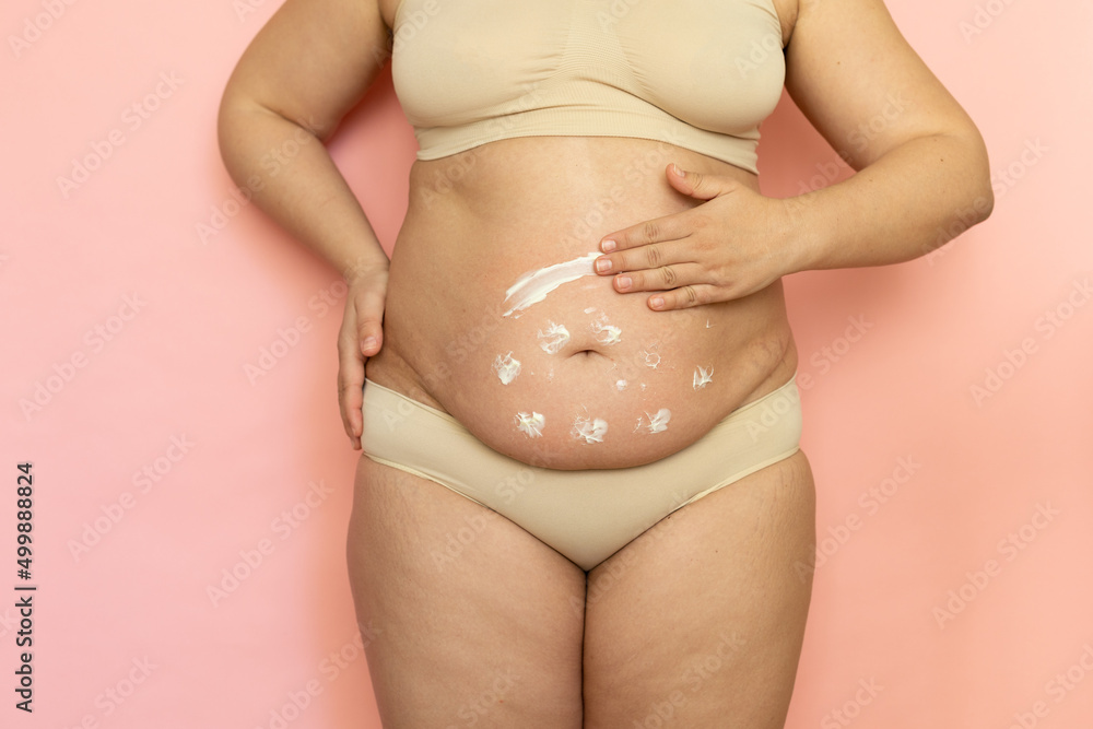 Φωτογραφία Cropped overweight woman in underwear applying moisturizer cream lotion to her abdomen