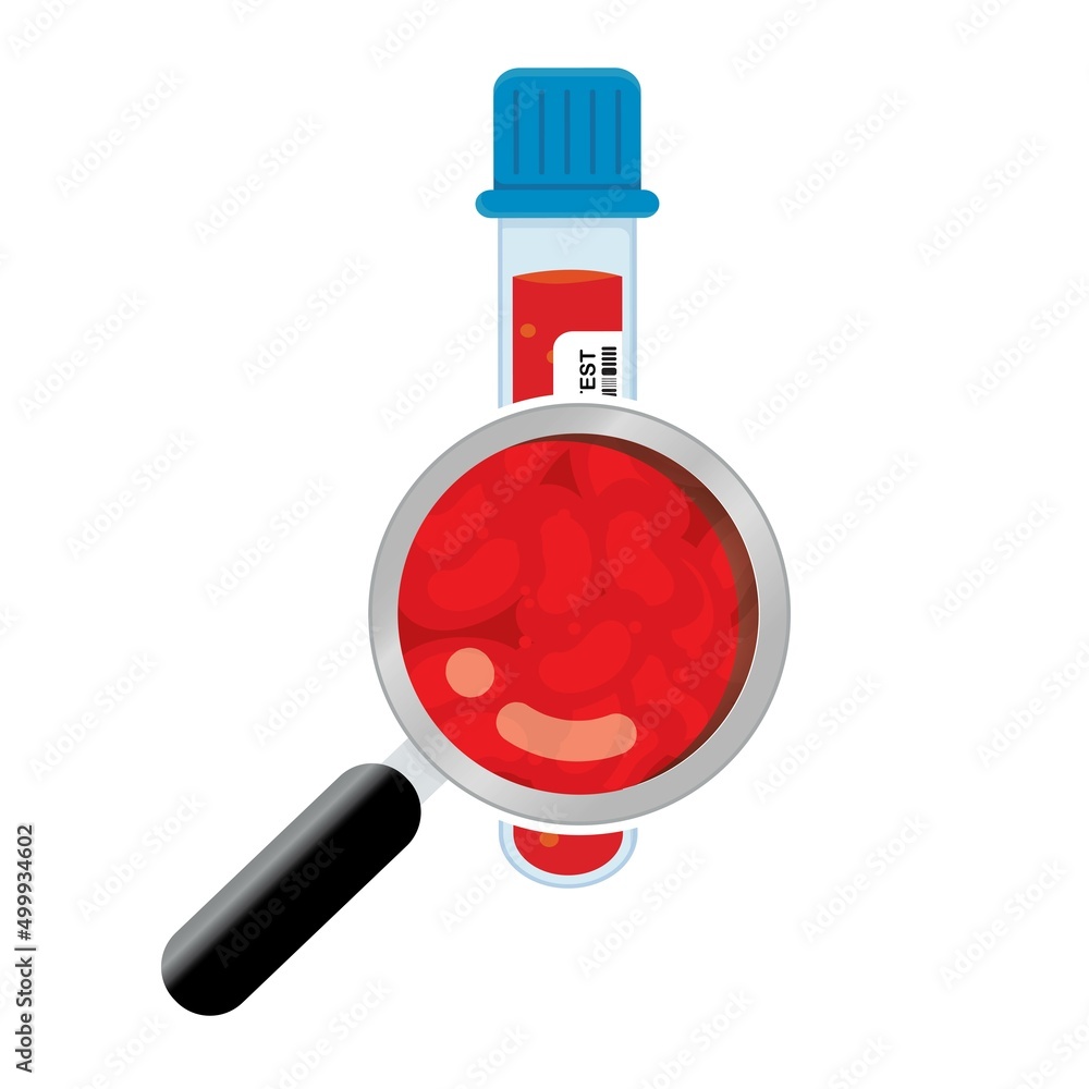 Test tube with blood and magnifying glass. Test tube with blood and magnifying glass.