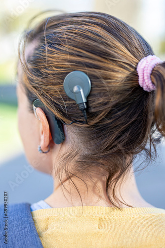 Woman head with cochleral implant hearing aid photo