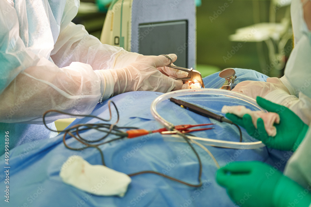 performing a medical operation in the operating room. hands of a surgeon in gloves close-up that hold the instrument, the hands of an assistant and a nurse performing a medical operation in the operating room. hands of a surgeon in gloves close-up that hold the instrument, the hands of an assistant and a nurse