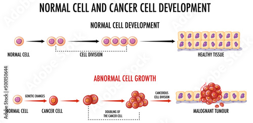Diagram showing normal and cancer cell