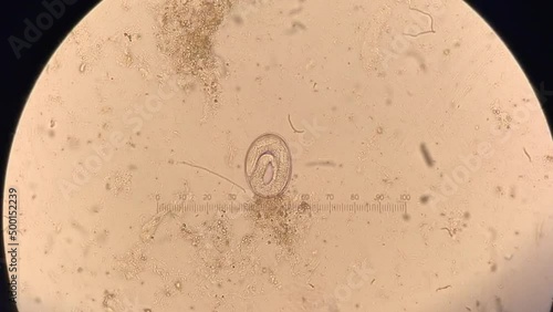 Nematode parasitic worm in microscope. larva inside ova movement photo