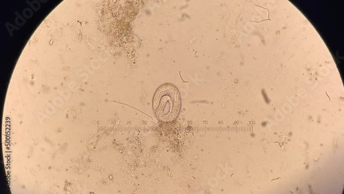 Nematode parasitic worm in microscope. larva inside ova movement