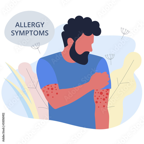 Seasonal allergy. man with red skin rash. Male scratching skin on his hand