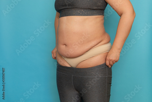 Obraz na plátně Back view of unrecognizable fat plump plus-size woman in grey sports bra, beige underpants, showing excess naked stomach, pulling on leggings on blue background