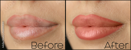 Fotografie, Obraz Collage with photos of young woman before and after permanent lip makeup, closeup