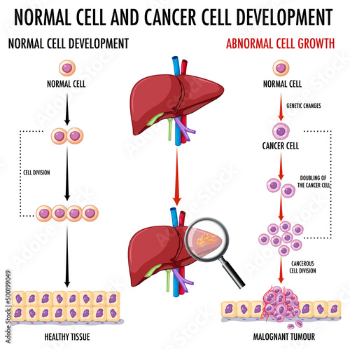 Diagram showing cancer development process
