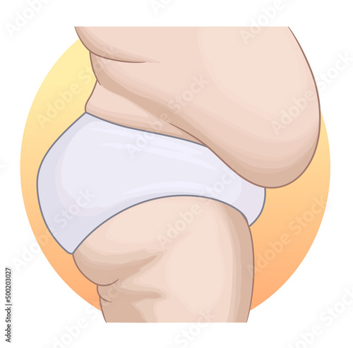 Overweight problem body abstract vector illustration. 