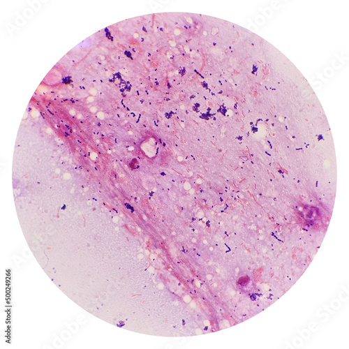 Quadro em tela Cocci and bacilli  bacteria in urine under 100X light microscope