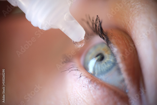 Obraz na płótnie Drops from vial dripping into woman eye closeup w salonie