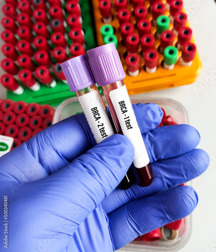 Blood sample for BRCA Genetic test, known as mutations, in genes called BRCA1 and BRCA2. photo