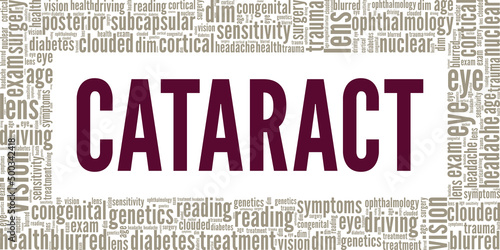 Cataract conceptual vector illustration word cloud isolated on white background.