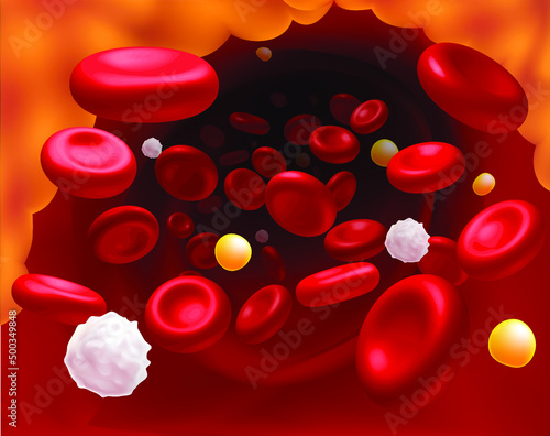 3D Illustration of red blood cells, white blood cells and cholesterol clogging the cause of death. medical use science, education