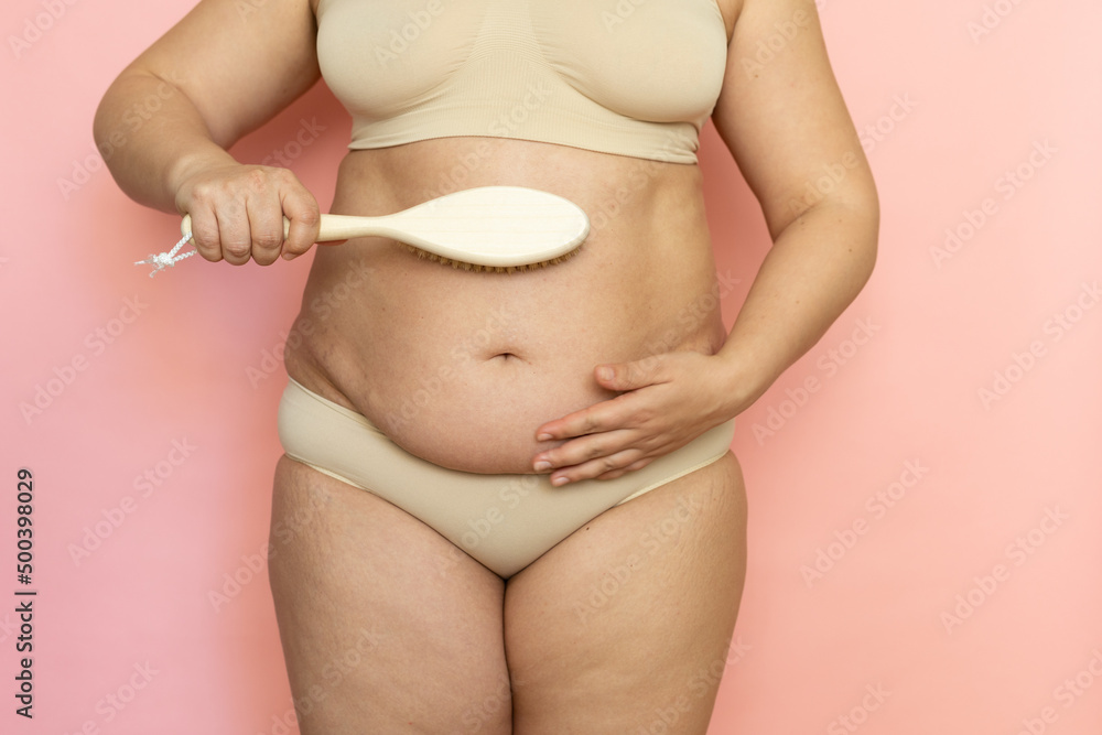 Cropped overweight woman touching belly in pants with excessive weight,  visceral fat abdomen. Brush dry massage, rubbing and cleaning. Make skin  turgor, get rid of hanging tummy. Loss weight. Stock-Foto | Adobe