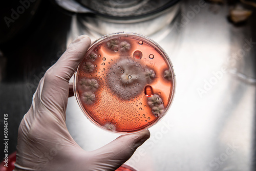 study of mold and bacteria in a petri dish with red agar. Mold spores and fungal mycelium photo