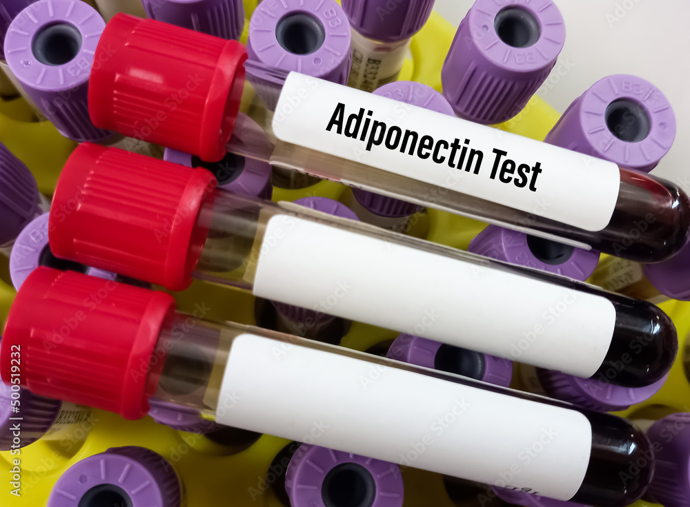 What Is Adp Blood Test? – Lab Test: ADP Platelet Aggregation – MYKLNN