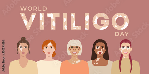 World vitiligo day June 25 banner. Female faces with different ethnics, skin colors, hairstyles with vitiligo skin disease. Body positive concept. Flat vector illustration