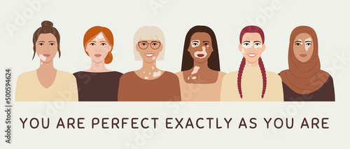 Female faces with vitiligo skin disease horizontal banner. You are perfect exactly as you are concept. Portraits with different ethnics, skin colors. Flat vector illustration