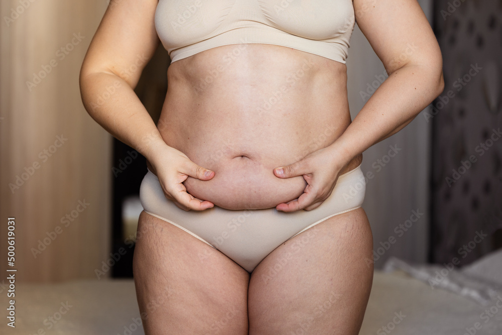 Cropped image of overweight woman, tucking, hiding fat naked big excessive abdomen with navel in underwear. Dangling down tummy. Drag away of abdomen. Planning liposuction surgery, cellulite problem Cropped image of overweight woman, tucking, hiding fat naked big excessive abdomen with navel in underwear. Dangling down tummy. Drag away of abdomen. Planning liposuction surgery, cellulite problem