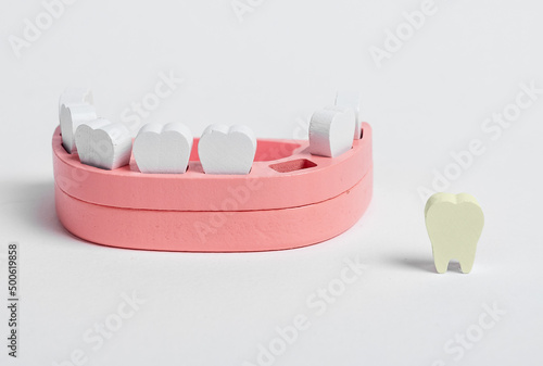 Wooden jaw model and fallen out bad tooth with plaque, cavity. Teeth diseases, inflammation, poor oral hygiene concept. Children game at dentist. High quality photo photo