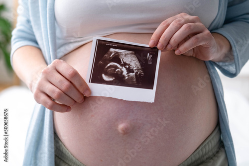 Quadro em tela Top view cropped of pregnant woman with ultrasound photo of fetus standing at ho