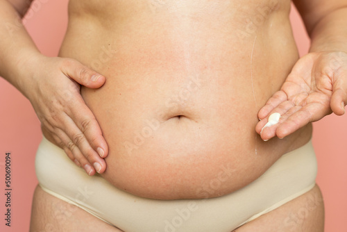 Cropped overweight woman in underwear applying moisturizer cream lotion to her abdomen. Belly fat removal. Wearing underwear  doing self massage to puffy skin. Cellulite obesity. Bodypositive