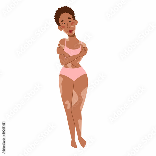 African-American slim woman with vitiligo. girl hugs herself. The concept of body positivity, self-acceptance. skin disease vitiligo. Vector isolated illustration in flat style on a white background.