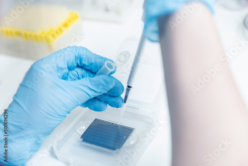 Tableau sur toile Macro photo hand of medical worker, Biochemical analyzer blood tests on modern e